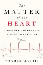 The Matter of the Heart: A History of the Heart in Eleven Operations