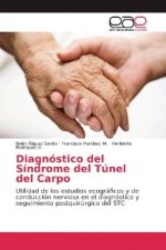 Diagnóstico del Síndrome del Túnel del Carpo