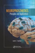 Neuroprosthetics