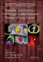 Principles and Practice of Image-Guided Radiation Therapy of Lung Cancer