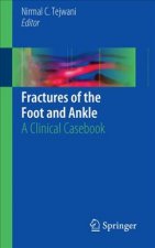 Fractures of the Foot and Ankle