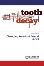 Changing trends of Dental Caries
