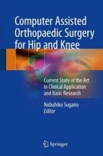 Computer Assisted Orthopaedic Surgery for Hip and Knee