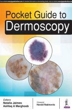 Pocket Guide to Dermoscopy