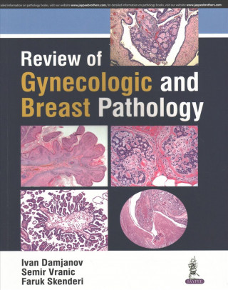 Review of Gynecologic and Breast Pathology