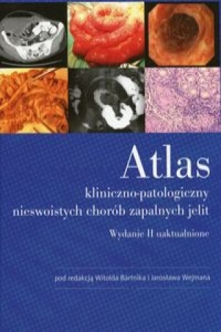 Atlas kliniiczno-patologiczny nieswoistych chorob zapalnych jelit