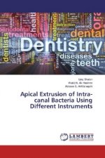 Apical Extrusion of Intra-canal Bacteria Using Different Instruments