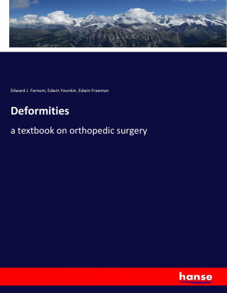 Deformities