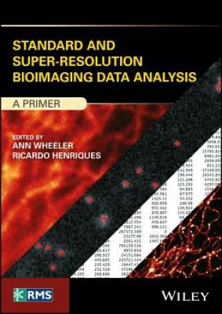 Standard and Super-Resolution Bioimaging Data Analysis - A Primer
