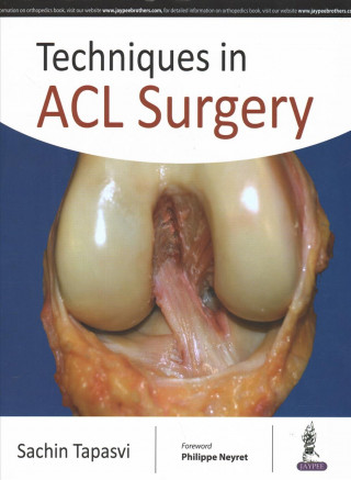 Techniques in ACL Surgery