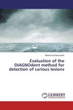 Evaluation of the DIAGNOdent method for detection of carious lesions