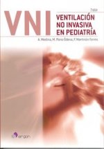 Ventilación no invasiva en pediatría