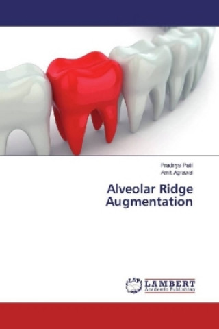 Alveolar Ridge Augmentation