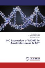 IHC Expression of MDM2 in Ameloblastomas & AOT