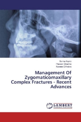 Management Of Zygomaticomaxillary Complex Fractures - Recent Advances (Sarika Kapila,Praveen Sharma,Naveen Chhabra)(Brožovaná)
