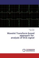 Wavelet Transform based approach for analysis of ECG signal