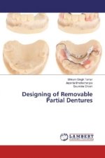 Designing of Removable Partial Dentures