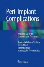 Peri-Implant Complications