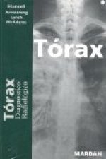 Tórax : diagnóstico radiológico
