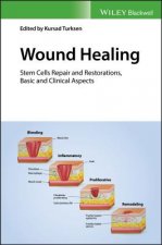 Wound Healing - Stem Cells Repair and Restorations , Basic and Clinical Aspects