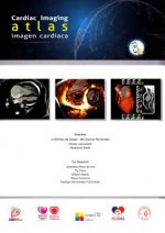 Atlas de Imagen Cardíaca-Cardiac Imaging Atlas