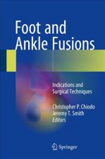 Foot and Ankle Fusions