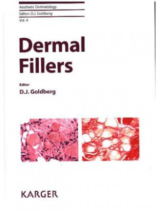 Dermal Fillers