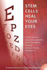 Stem Cells Heal Your Eyes: Prevent and Help: Macular Degeneration, Retinitis Pigmentosa, Stargardt, Retinal Distrophy, and Retinopathy.