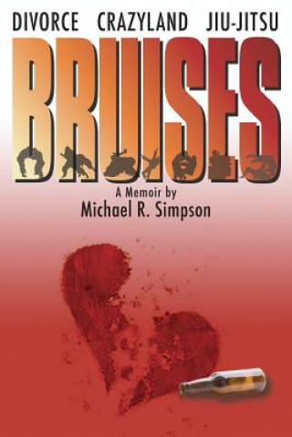 Bruises