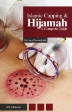 Islamic Cupping & Hijamah: A Complete Guide