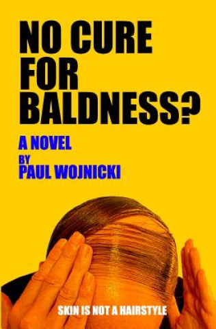 No Cure For Baldness?