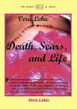 Death, Scars, and Life