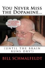 You Never Miss the Dopamine...: (until the brain runs dry!)