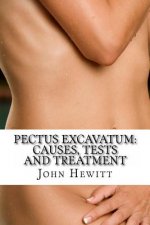 Pectus Excavatum: Causes, Tests and Treatment