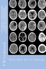 CT Head: DIAGNOSIS A Radiographers Guide To Reporting Part 1 Acute Trauma: Part One Acute Trauma