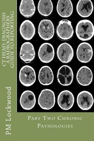 CT Head: DIAGNOSIS A Radiographers Guide To Reporting Part 2 Chronic Pathologies: Part 2 Chronic Pathologies