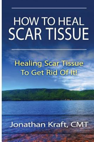 How to Heal Scar Tissue: How to Heal Your Own Scar Tissue And Get Rid Of It!