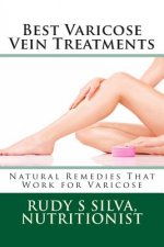 Best Varicose Vein Treatments: Natural Remedies That Work for Varicose