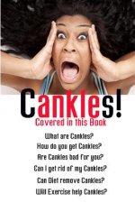 Cankles: This Guide will answer all of your Cankles questions