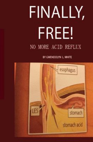 Finally, Free!: No More Acid Reflux