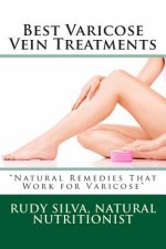 Best Varicose Vein Treatments: Natural Remedies That Work for Varicose