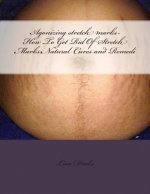 Agonizing stretch marks-How To Get Rid Of Stretch Marks: Natural Cures and Remedi