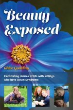 Beauty Exposed: Captivating stories of life with siblings who have Down syndrome