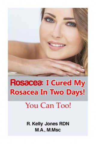 Rosacea: I Cured My Rosacea In Two Days! You Can Too! (R Kelly Jones,Cavenaugh Kelly)()