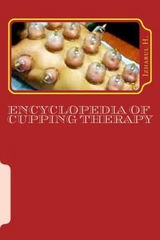 Encyclopedia of Cupping Therapy: Al-Hijama