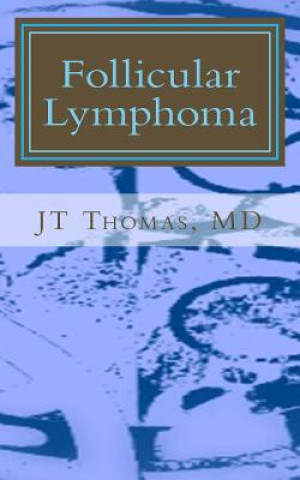 Follicular Lymphoma: Fast Focus Study GUide