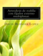 Artrodesis de rodilla con fijador externo multiplanar.