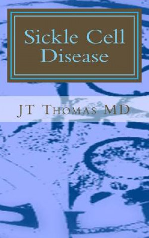 Sickle Cell Disease: Fast Focus Study Guide