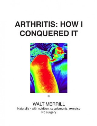 Arthritis: How I Conquered It!: Naturally: with nutrition, supplements, exercise- Not surgery