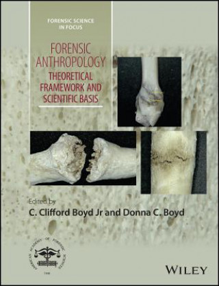 Forensic Anthropology - Theoretical Framework and Scientific Basis